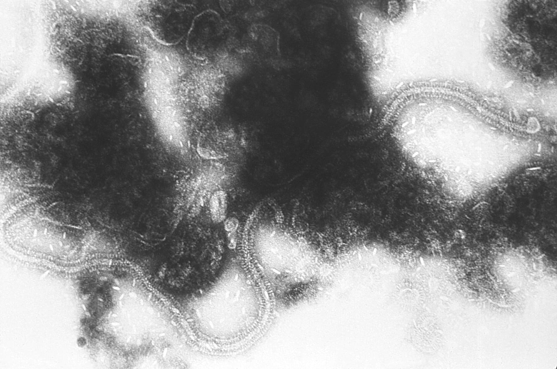 Micrografia in bianco e nero con strutture filamentose del genoma a RNA del virus RSV.